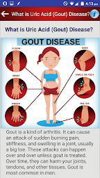 Arthritis Gout Uric Acid Diet