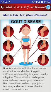 Arthritis Gout Uric Acid Diet
