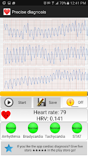 Cardiac diagnosis (arrhythmia) 146 Screenshots 3