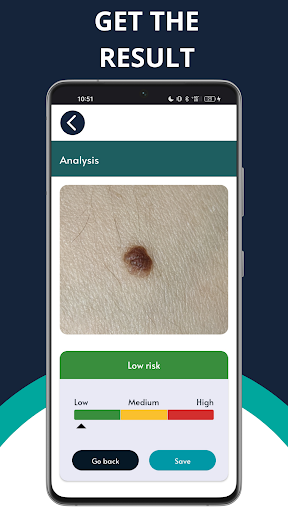 DermObserver: dermatology scan Screen 2