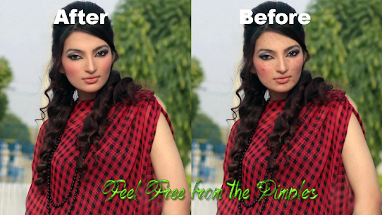 Pimples removing photo editing app 4