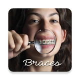 Braces - Photo Editor icon
