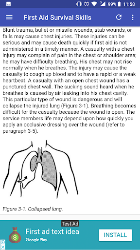 First Aid Survival Skills