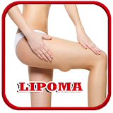 Lipoma Disease Problem icon