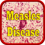 Measles Disease icon