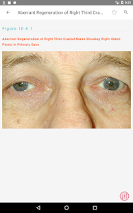 Скачать The Wills Eye Manual - 200+ Ophthalmic Conditions Онлайн бесплатно на Андроид