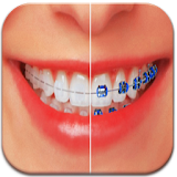 Braces Teeth Booth Maker Pro icon
