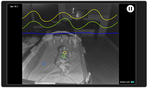Viewer for Baby Monitor Xbox