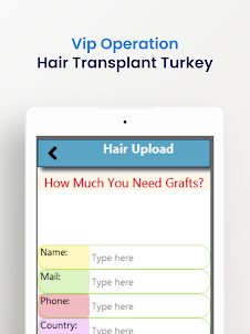 Hair Transplant Turkey / Graft