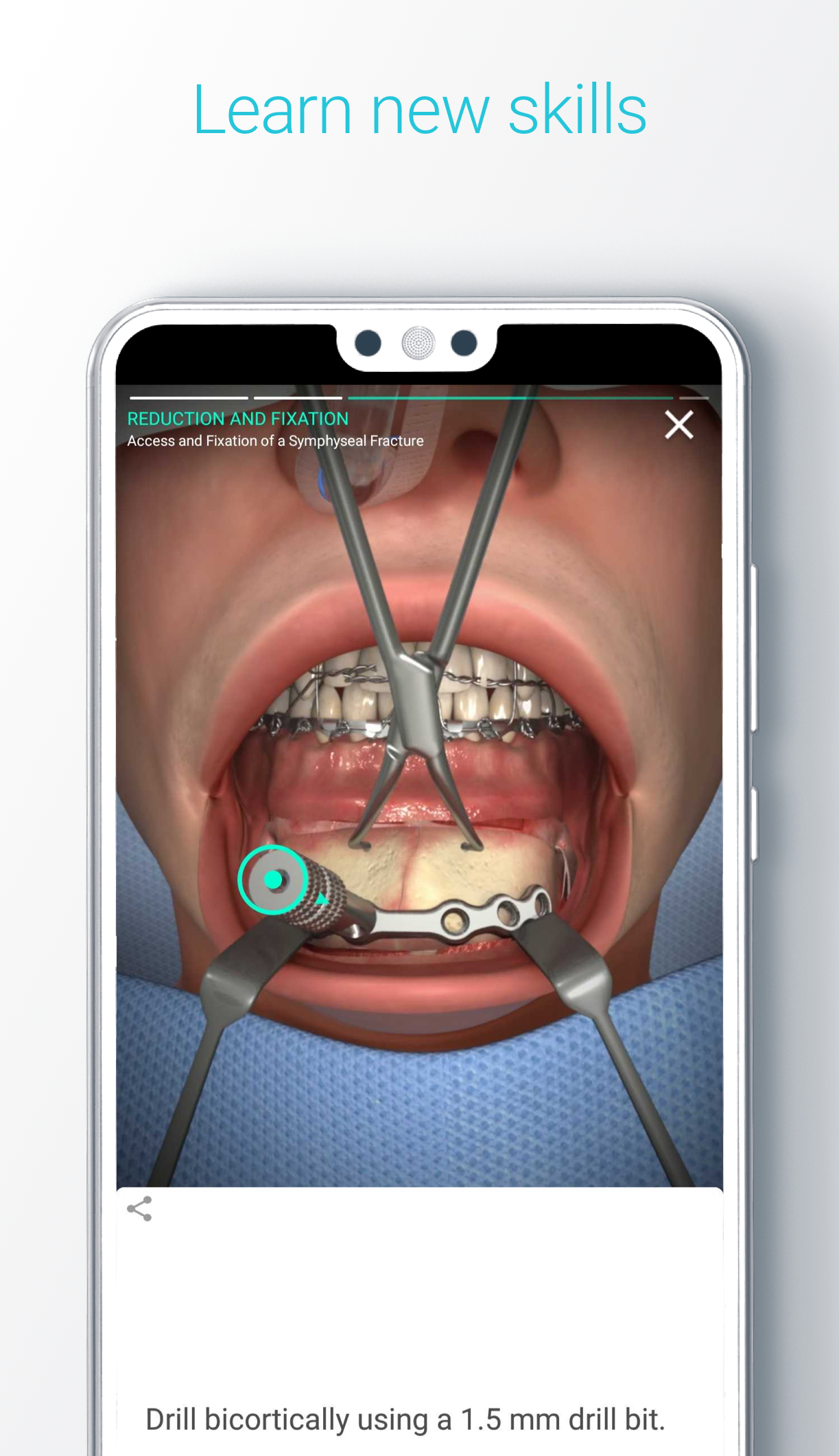 Android application Touch Surgery: Surgical Videos screenshort