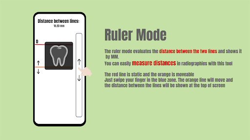 Smart Negatoscope Screen 2