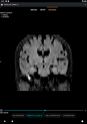 S.I.A Neurovascular Care