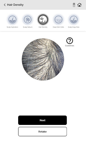 My Scalp ID Screen 3