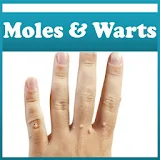 Moles and Warts Removal icon