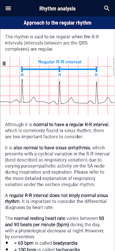 ECG APPtitude Screen 3