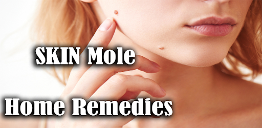 Skin Moles, Remédies to Remove