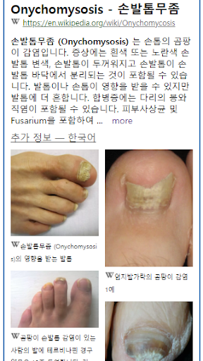 Model Dermatol – Skin Disease screenshot 4