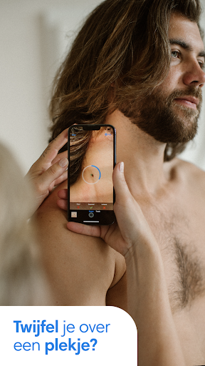 SkinVision - herken huidkanker