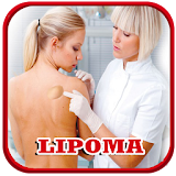 Lipoma Disease Help icon