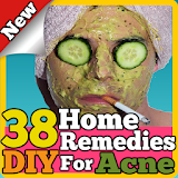 38 DIY Home Remedies For Acne icon