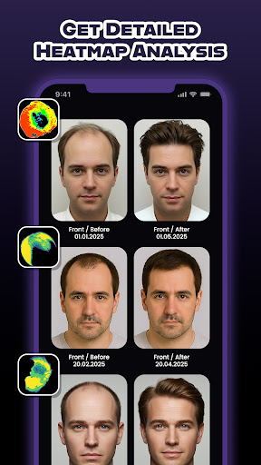 Screenshot of HairCode·Hair Loss Scanner AI