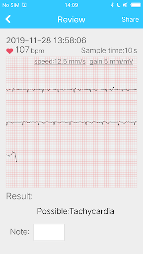 Mini ECG Aide Screen 3