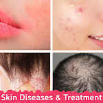 Skin Diseases and Treatments Apk