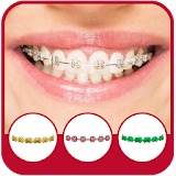 Braces Camera Effects icon