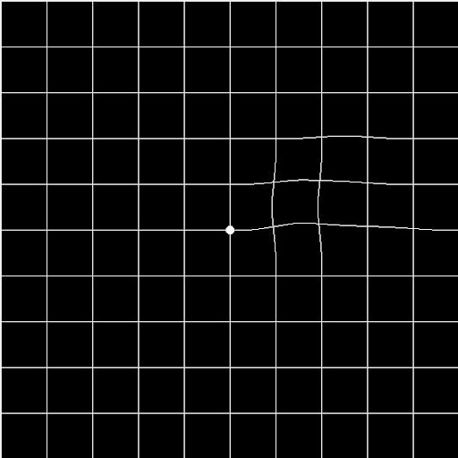AMD, A Metamorphopsia Detector Screen 3