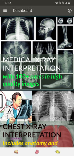 X-RAY Interpretation - cases Screenshot