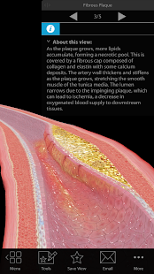Physiology & Pathology(圖2)-速報App