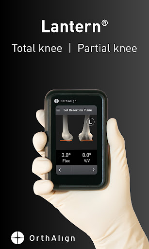 Android application Lantern demo app screenshort