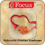 Top 10 Education Apps Like Polycystic Ovarian Syndrome - Best Alternatives