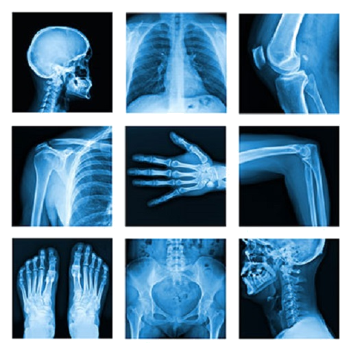 Medical X-Ray Interpretation w  Icon