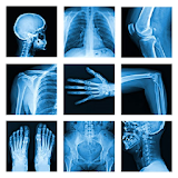 Medical X-Ray Interpretation with 100+ Cases icon