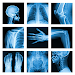 Medical X-Ray Interpretation w APK