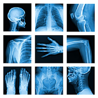 Medical X-Ray Interpretation with 100+ Cases