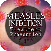 Measles Virus Infection Treatment & Prevention