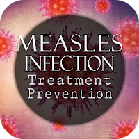 Measles Virus Infection Treatm