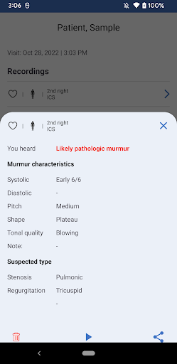 eMurmur® Screenshot