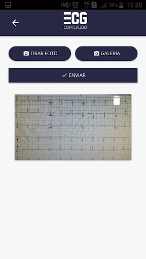 ECG com Laudo Screen 2