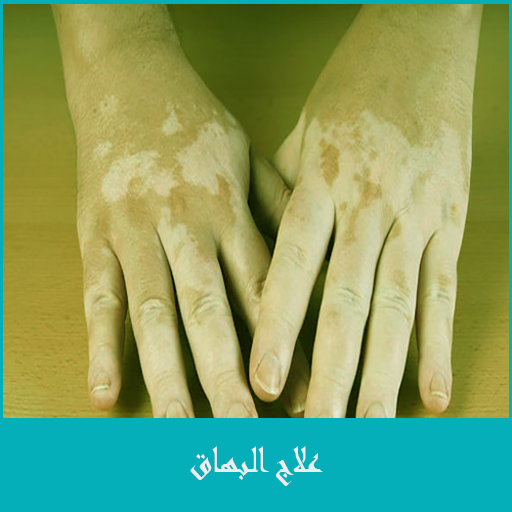 علاج البهاق logo