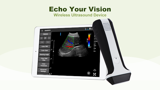 LELTEK Ultrasound - LeSono  Screenshots 1