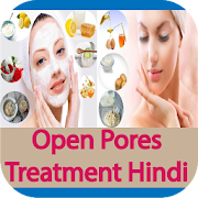 Open Pores Treatment Hindi