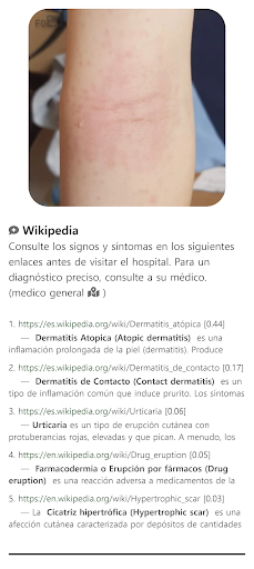 ModelDerm–Enfermedades la piel screenshot 6
