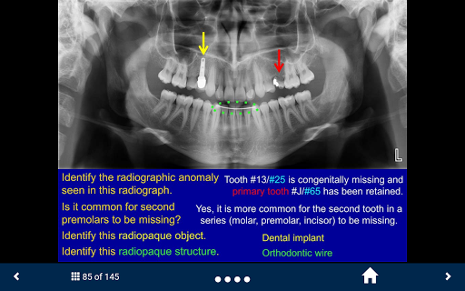 Oral Radiology - SecondLook Screen 2