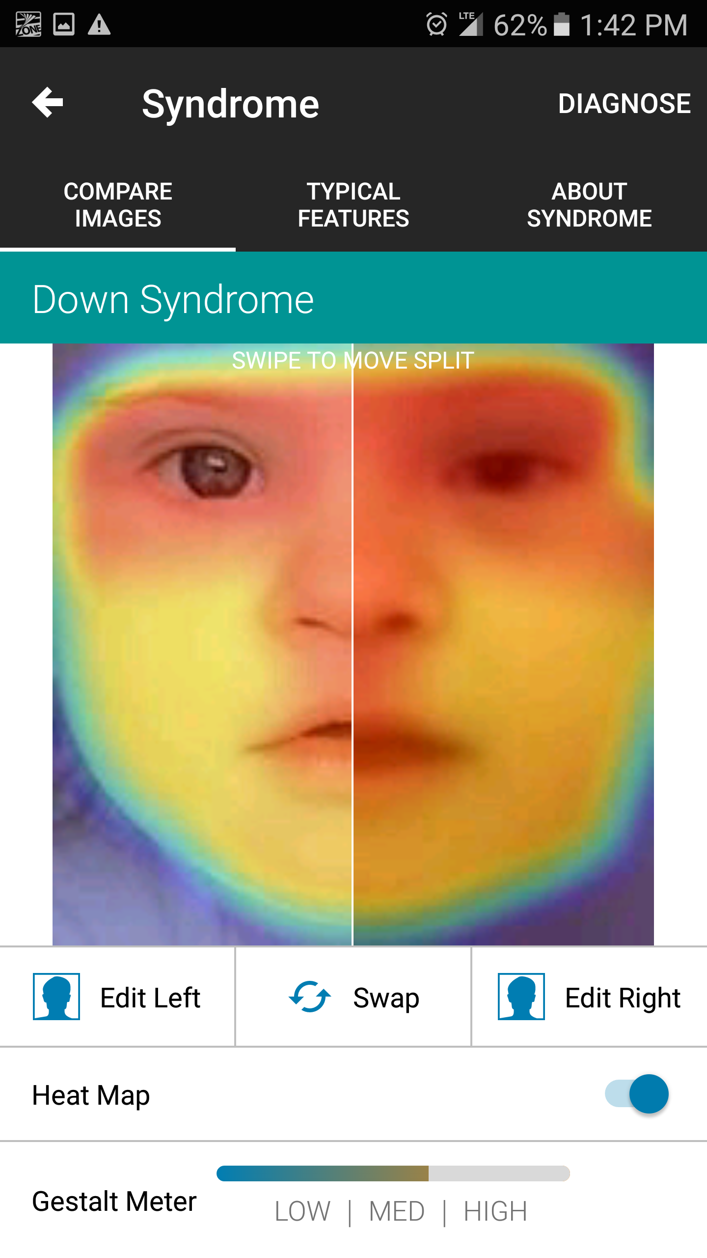 Android application Face2Gene screenshort