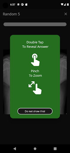 X-Ray Flashcards Tuberculosis Screen 2