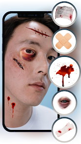 Screenshot 10 Heridas En Fotos Reales android