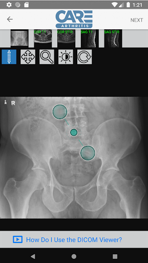 Care Arthritis Mobile Screen 2
